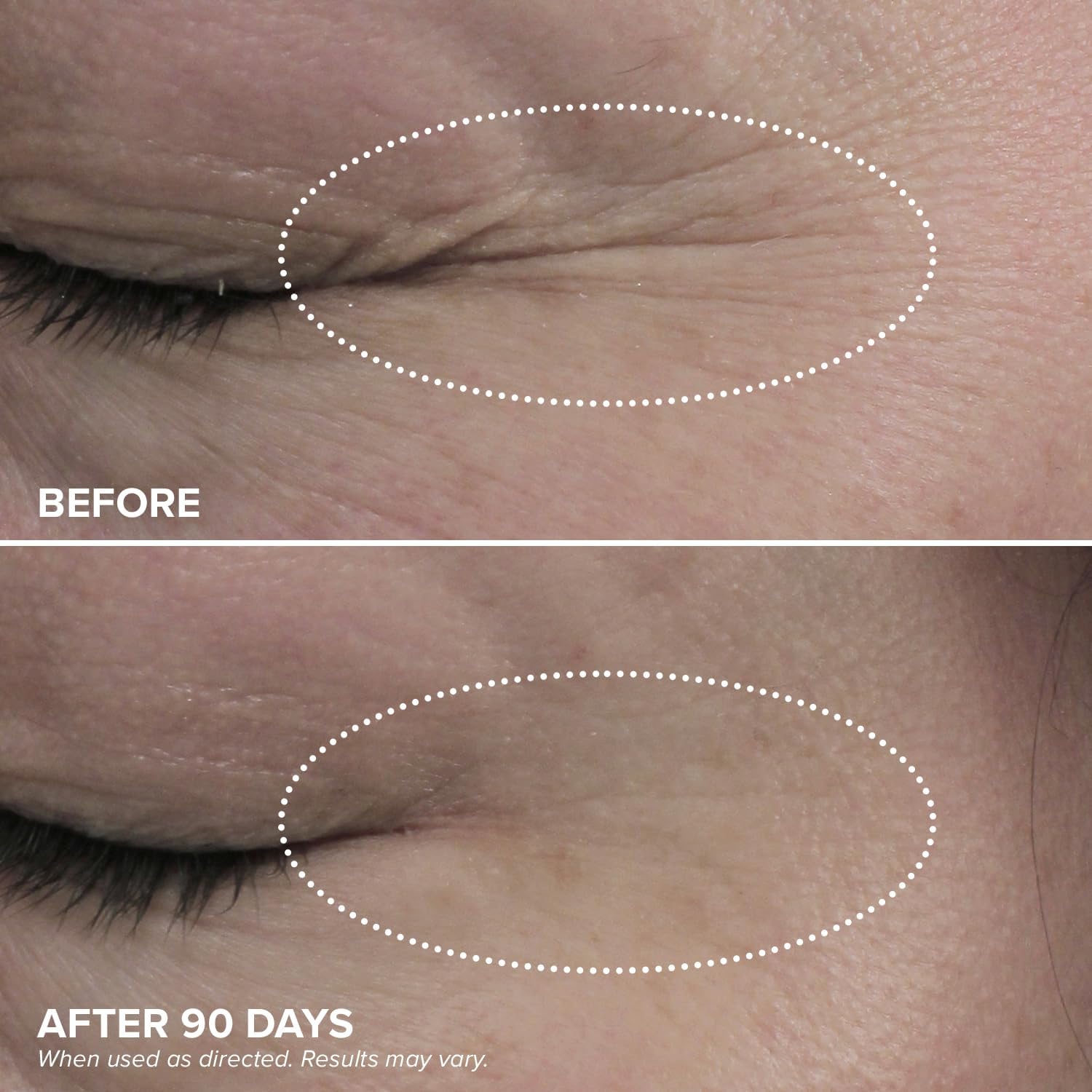 DRMTLGY HPR Eye Cream texture swirl shows a silky, breathable hydration for under-eye skin.