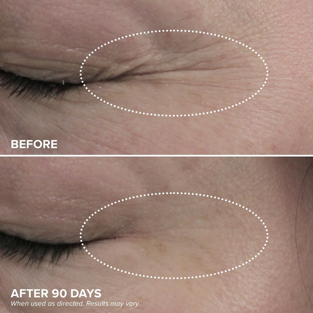 DRMTLGY HPR Eye Cream texture swirl shows a silky, breathable hydration for under-eye skin.