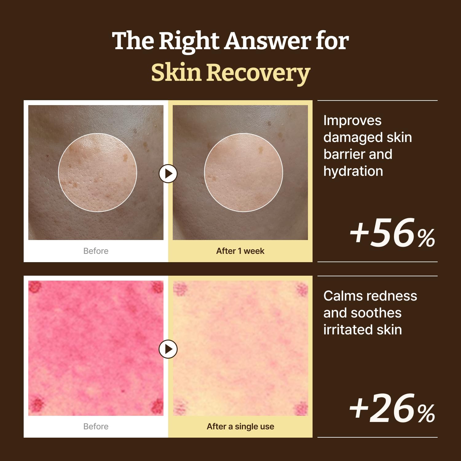 Dr.Reju-All PDRN Advanced Cream packaging highlights travel-friendly size.