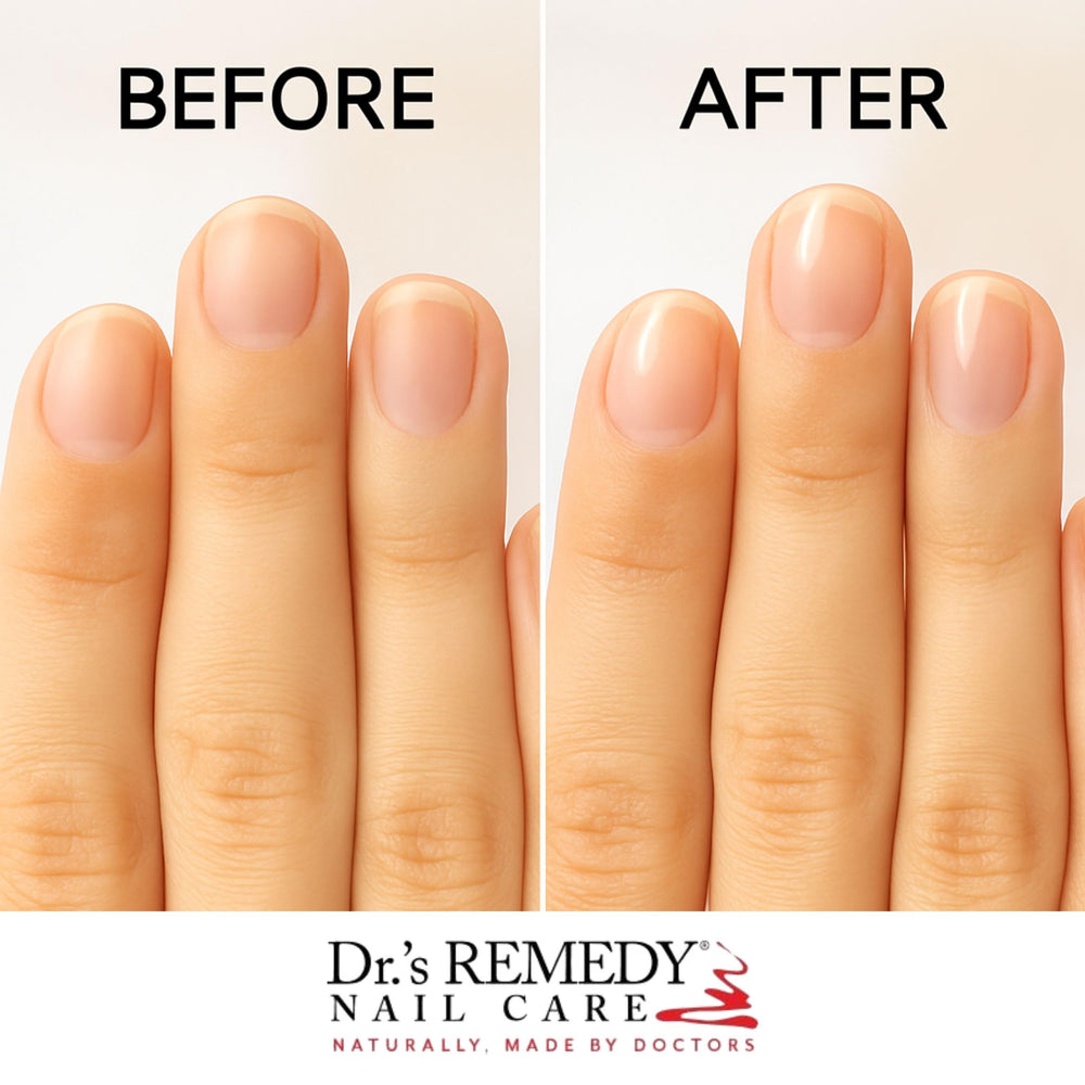 Dr.'s Remedy TOTAL base-top coat clear glaze delivering long-wear and UV-resistant gloss