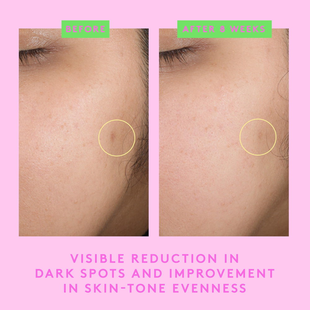 Drunk Elephant B-Goldi Bright Drops contains 5 percent niacinamide for tone
