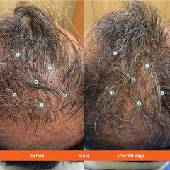 DS Laboratories Revita shampoo hair volume close-up demonstrating lifted look