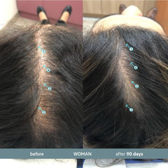 Revita.SOD bottle label highlighting zinc and Ashwagandha for scalp vitality