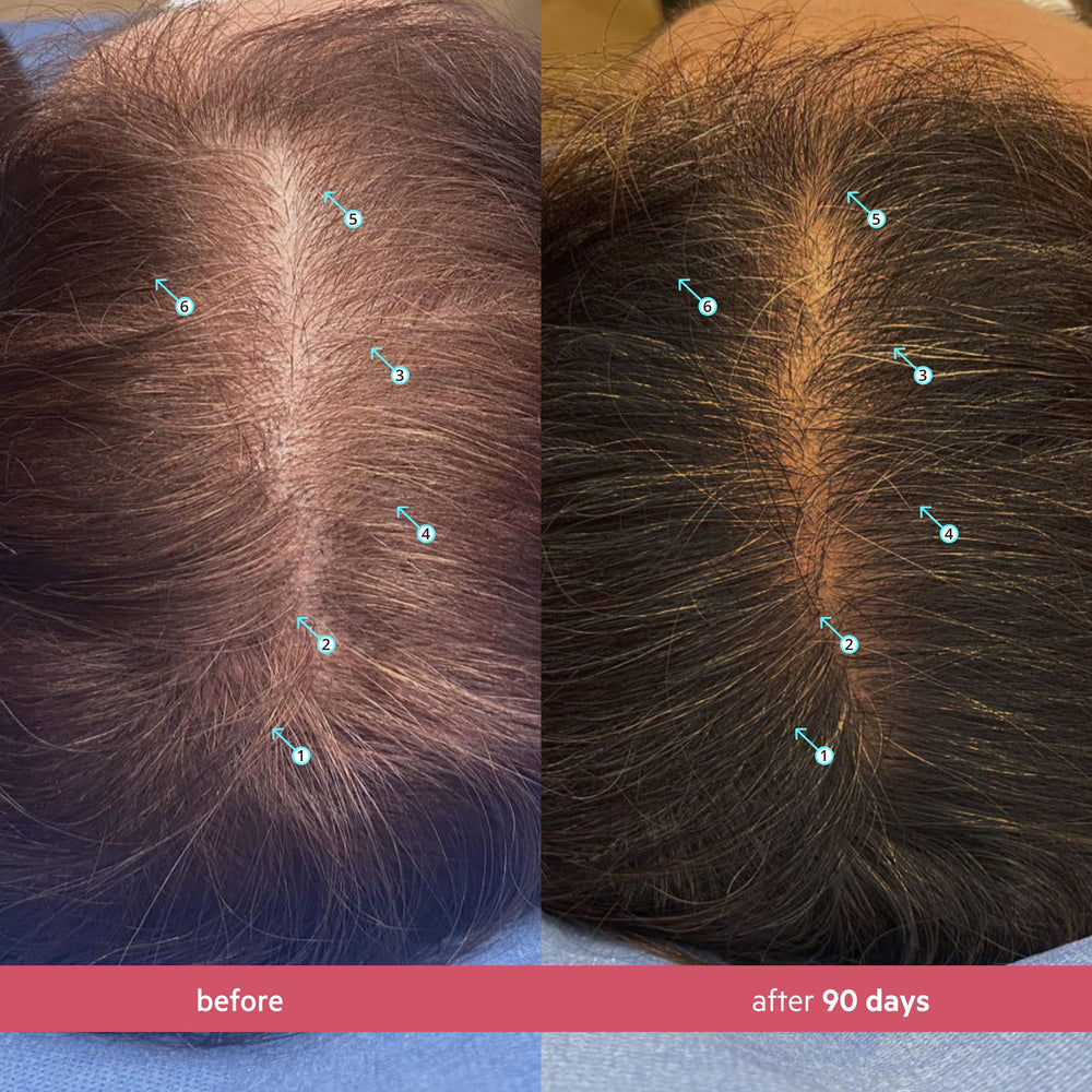 DS Laboratories Spectral Women’s Hair Density Serum texture closeup shows lightweight, non-greasy feel for all hair types.