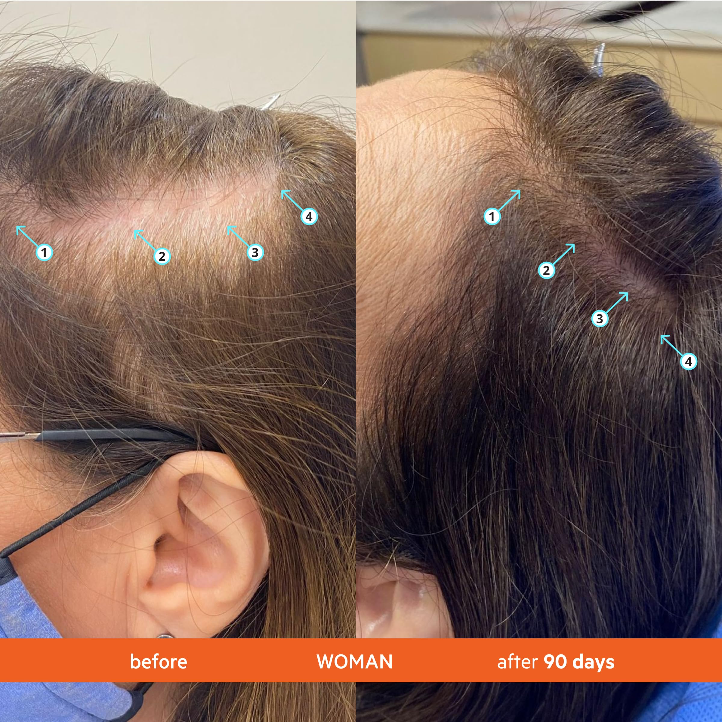 DS Laboratories Revita Conditioner on hair during application suggests fuller-looking, smooth results.