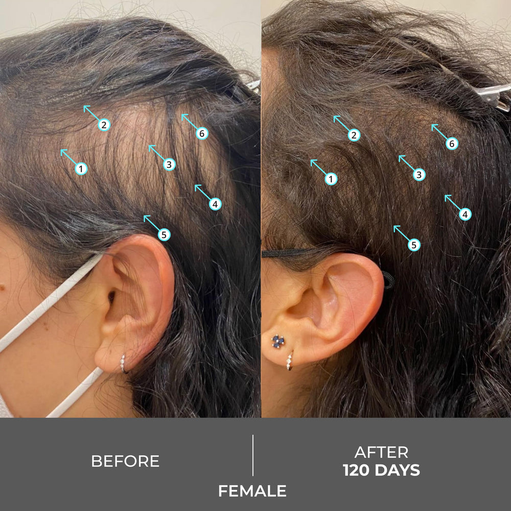 DS Labs Revita nanoxidil ingredient image highlighting advanced scalp care
