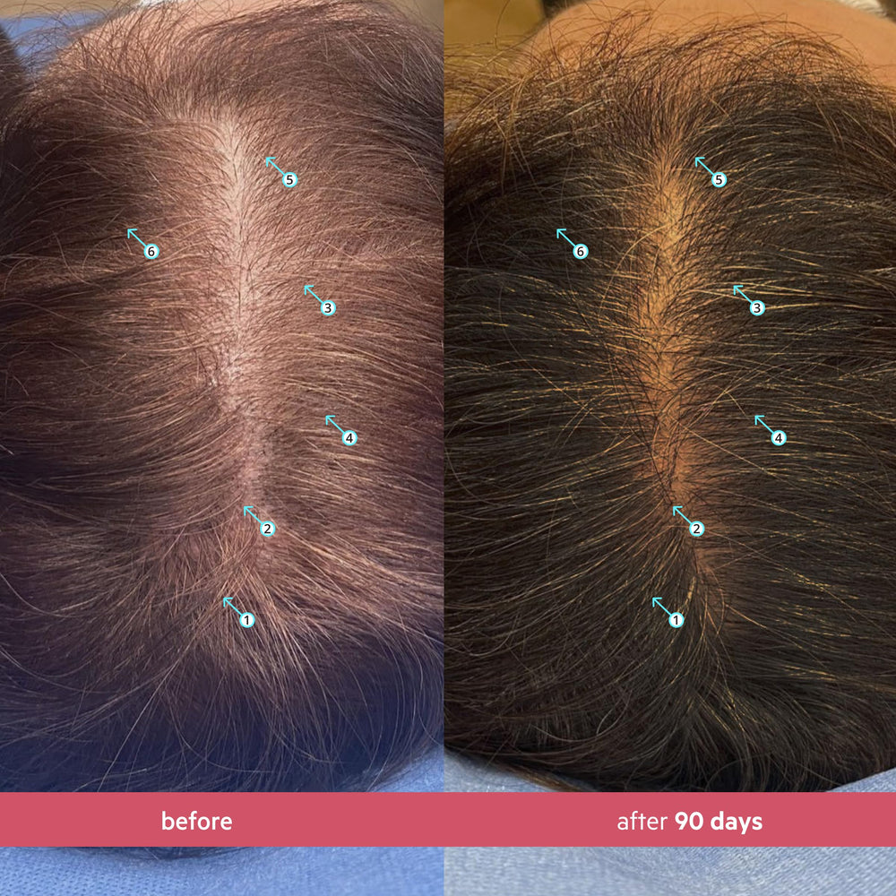 DS Laboratories Spectral Women's Hair Density Serum application on scalp—targeted care in routine.
