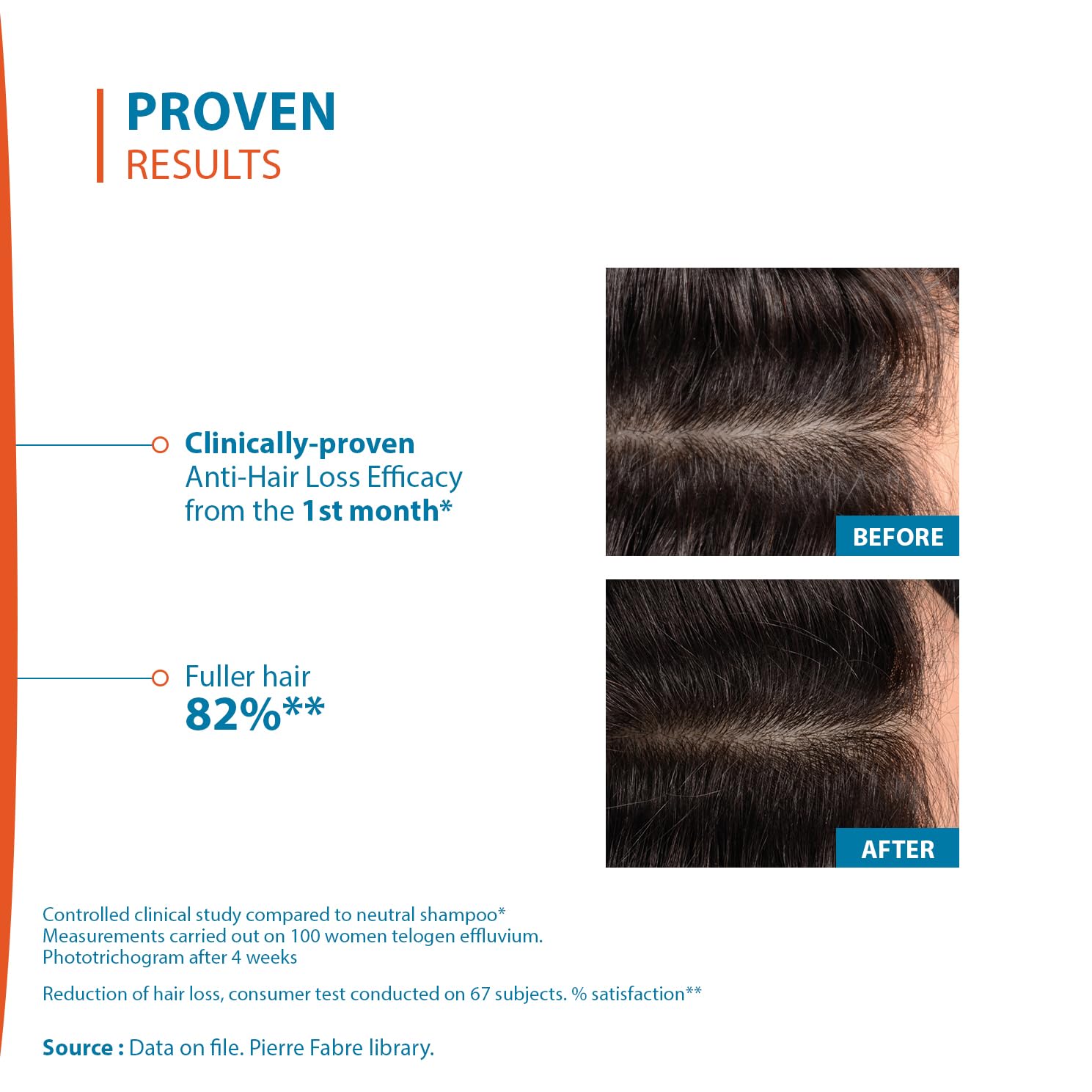 Ducray Creastim Reactiv bathroom scene for daily hair care.