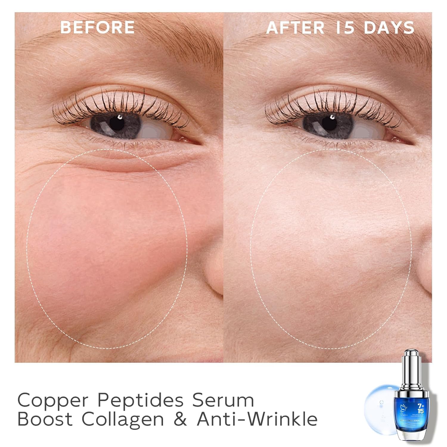 Dumie hyaluronic acid detail emphasizes deep hydration in formula.