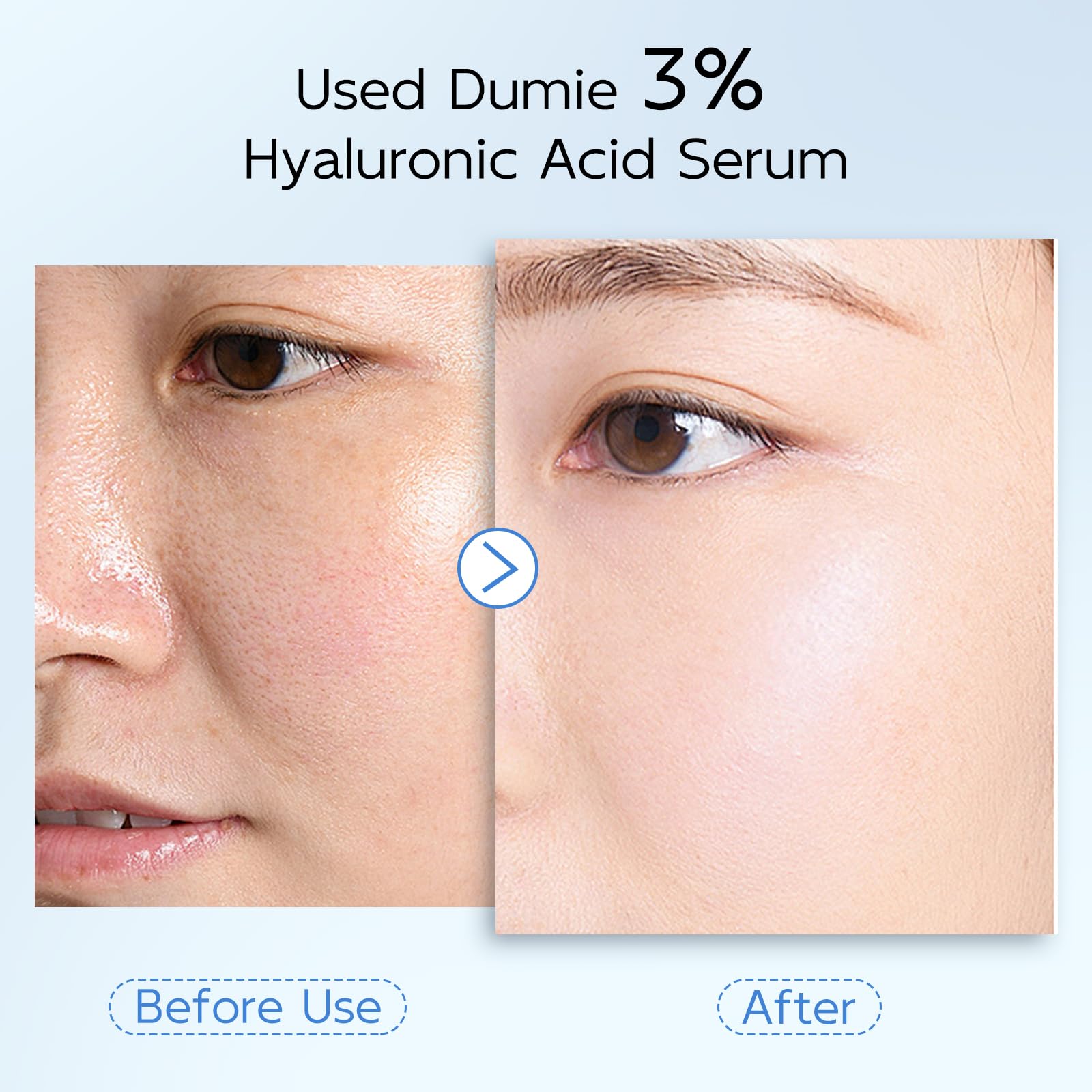 Dumie hyaluronic acid serum glow on skin close-up.