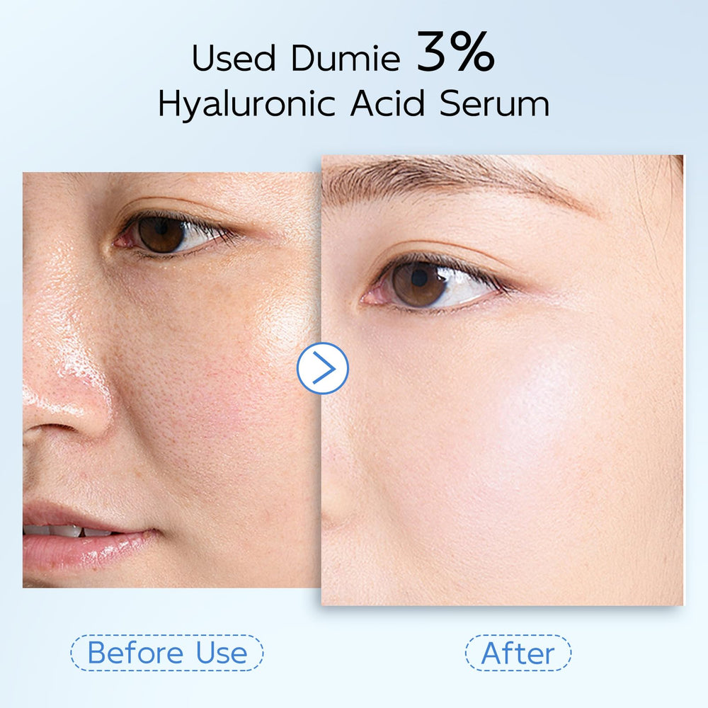 Dumie hyaluronic acid serum glow on skin close-up.
