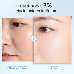 Dumie hyaluronic acid serum glow on skin close-up.