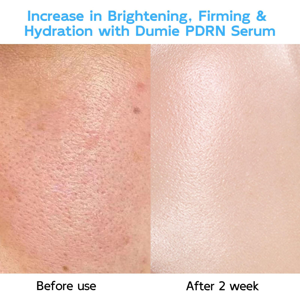 Dumie Niacinamide Glutathione focus suggests even skin tone benefits