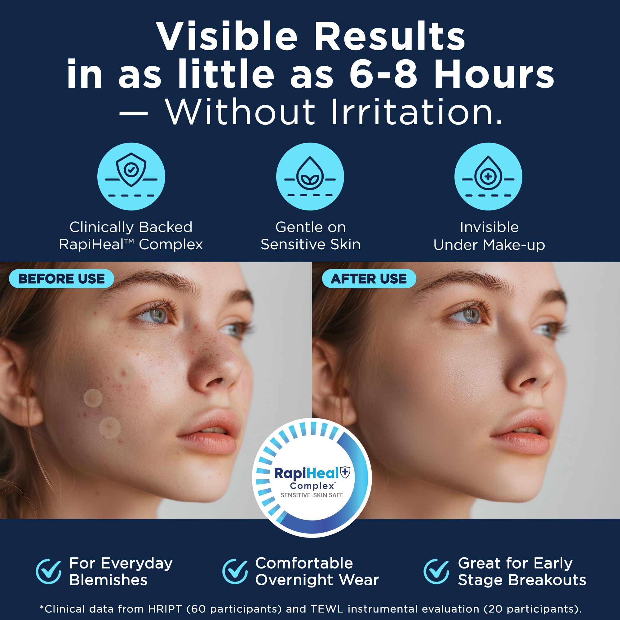 Dura Cleanse Pimple Patches large size for stubborn pimples.