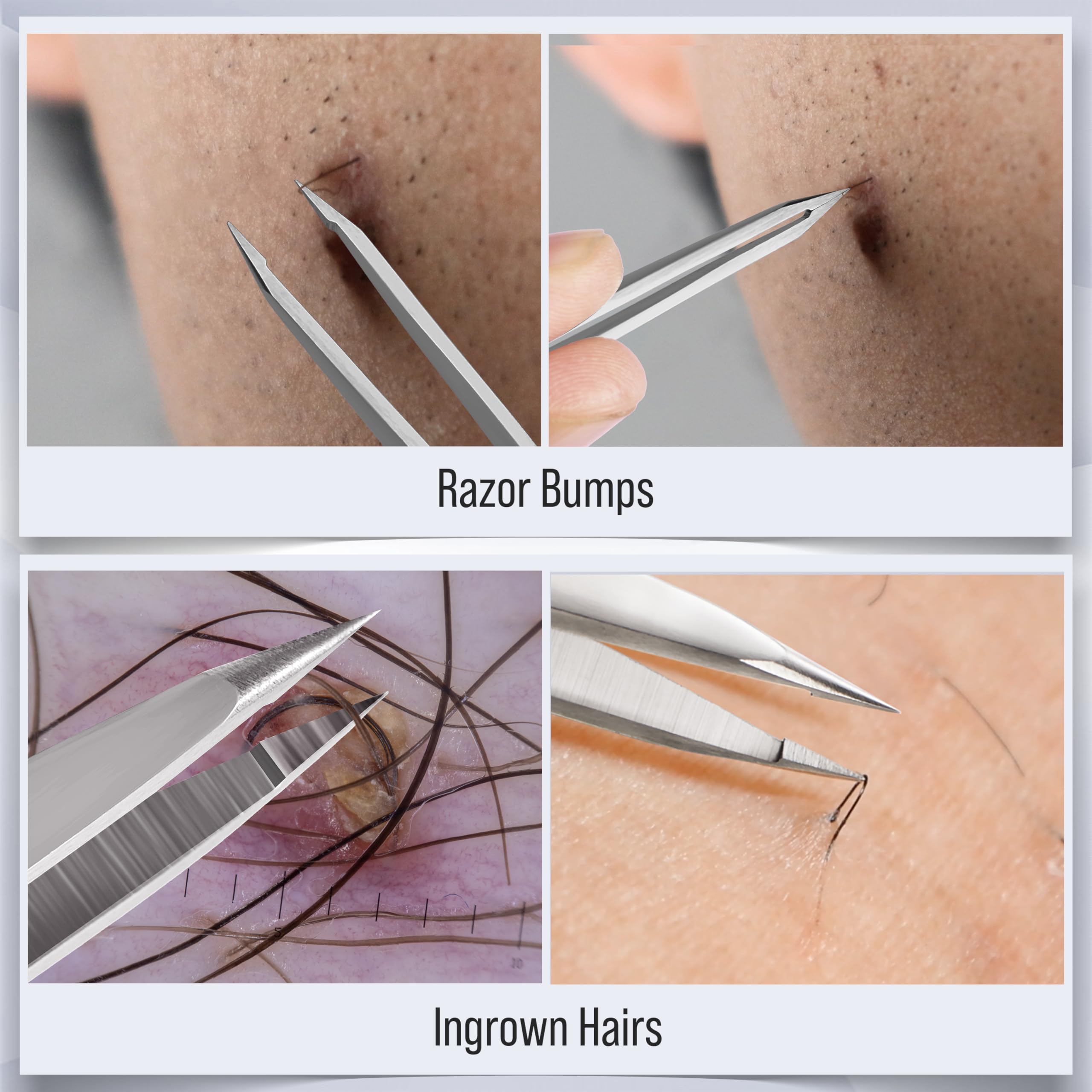 DuroX Ingrown Hair Tweezers tension-balanced action supports smooth plucking