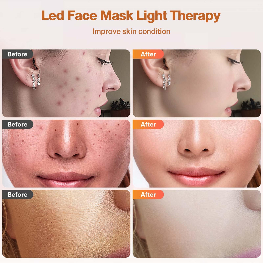 DZAVOK soft silicone mask close-up showing gentle, comfortable fit
