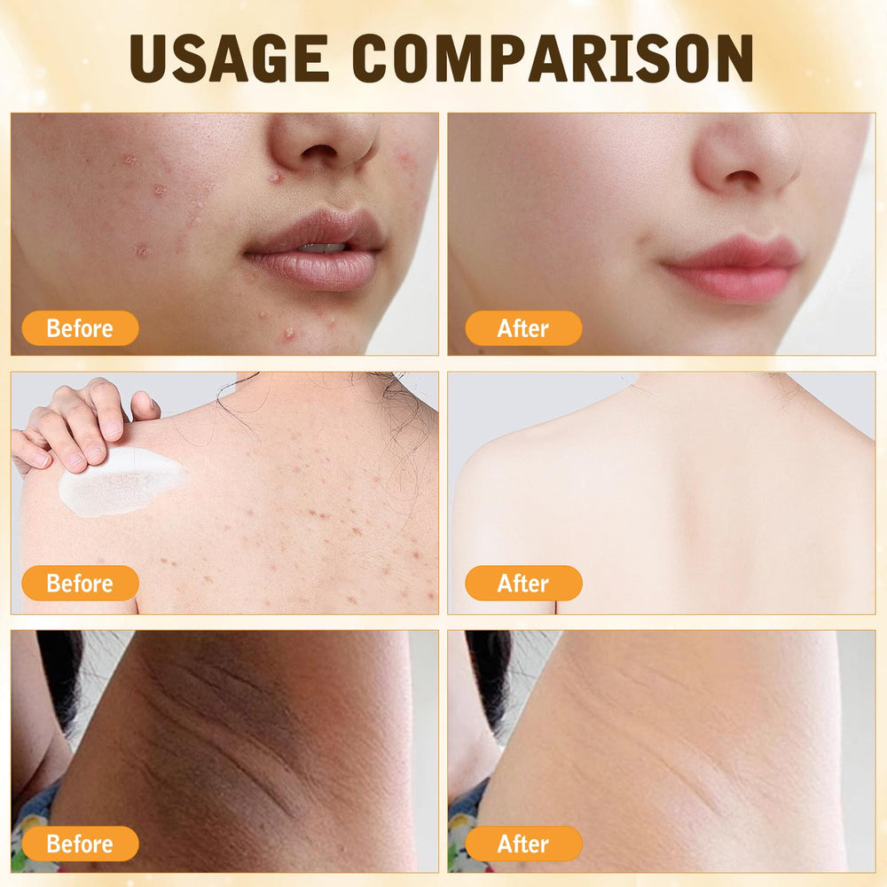 DZCKTFYGRT Bee Venom Cream on dry skin offers hydrating protection in harsh climates