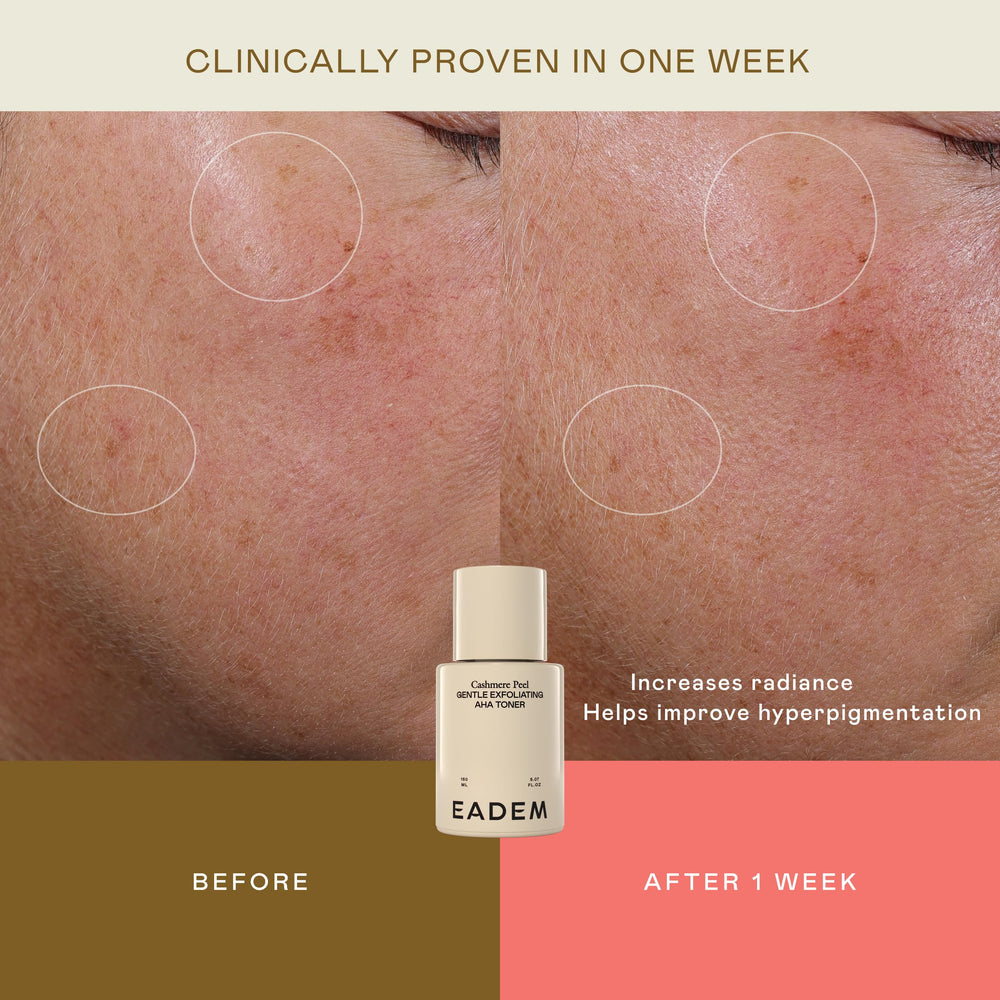 EADEM Cashmere Peel texture-closeup—refined pores and even tone.