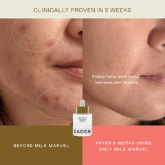 EADEM fragrance-free label on bottle signaling gentle, allergy-friendly dark spot care