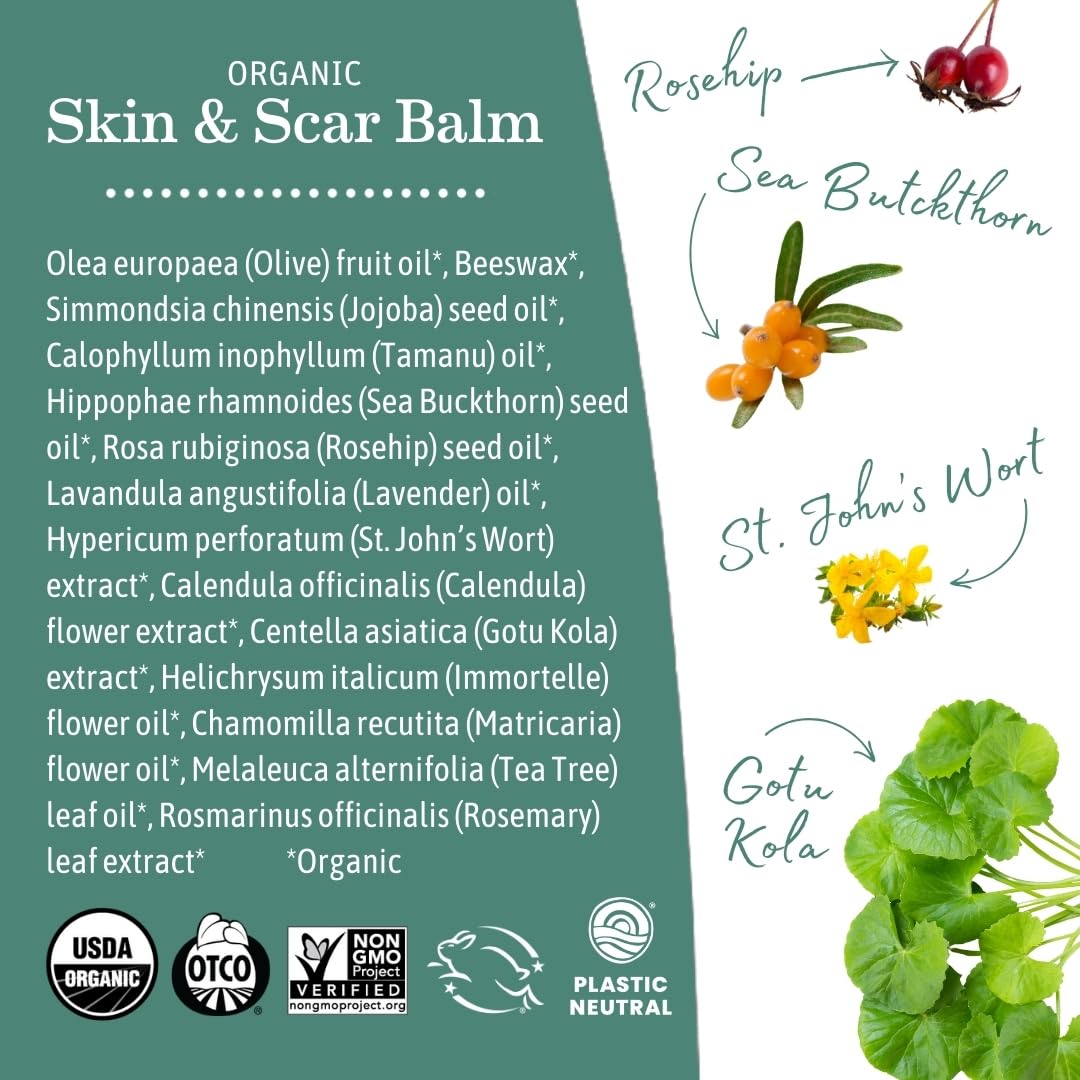 Earth Mama calendula ingredient provides soothing botanical care
