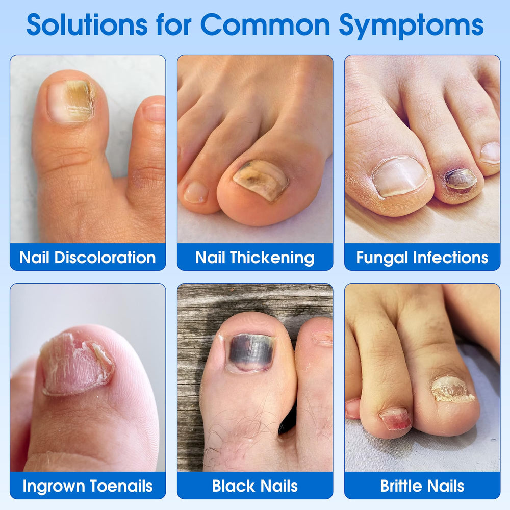 Closeup of applying an EASICUTI patch to a toenail for overnight use.