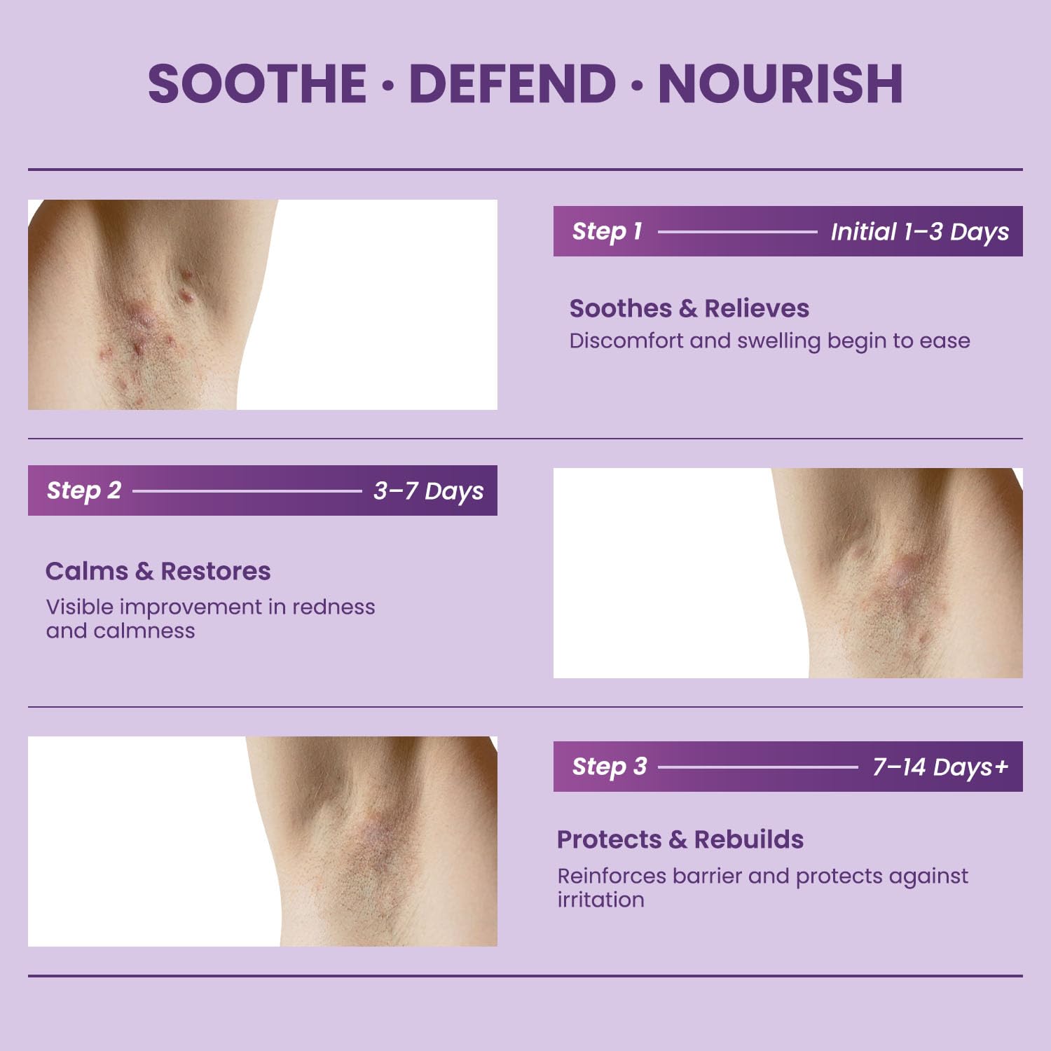 Easment Flare Defense Balm non-greasy texture closeup shows fast absorption.