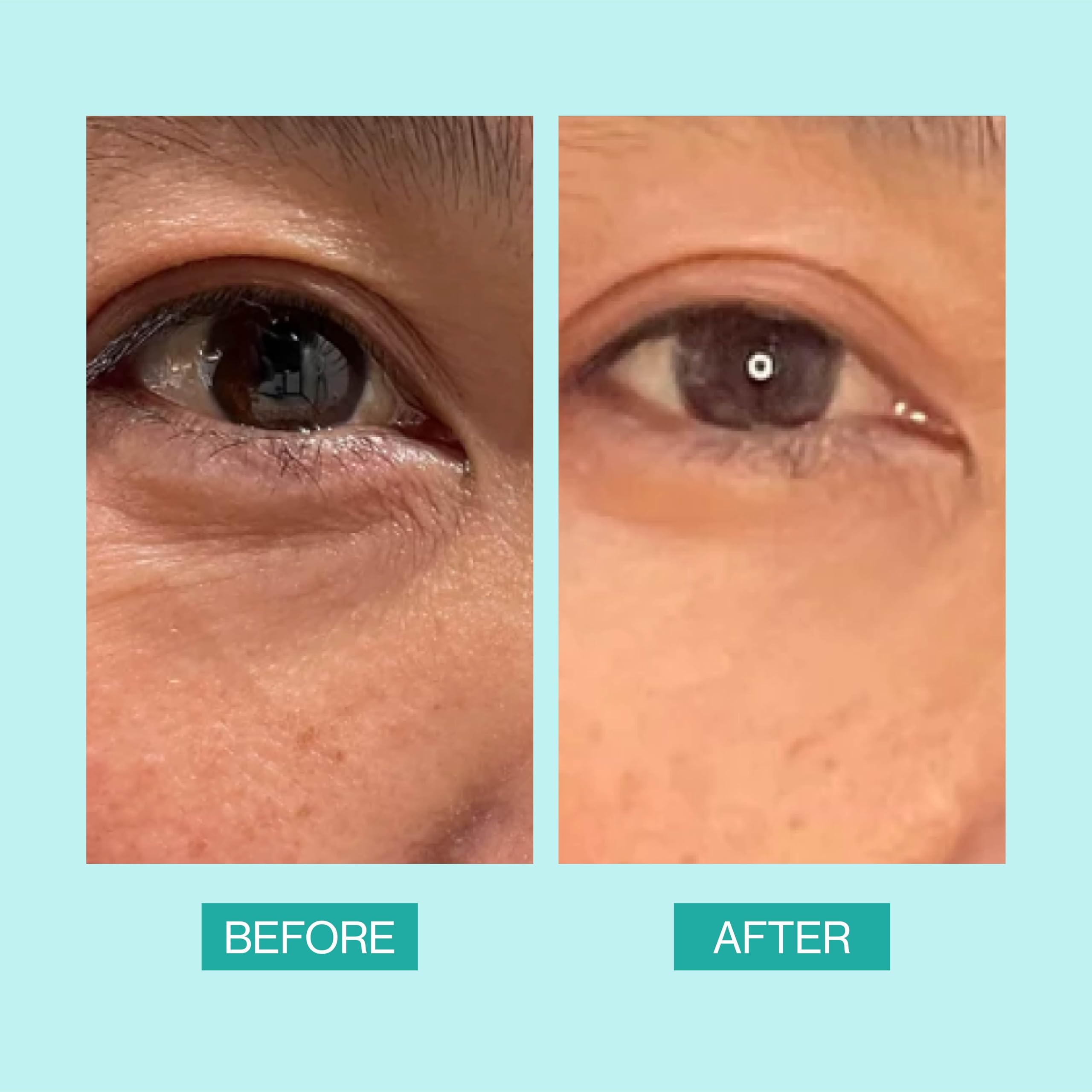 eb5 Daily Repair Eye Treatment vitamin E image emphasizes hydration and protection from environmental stressors