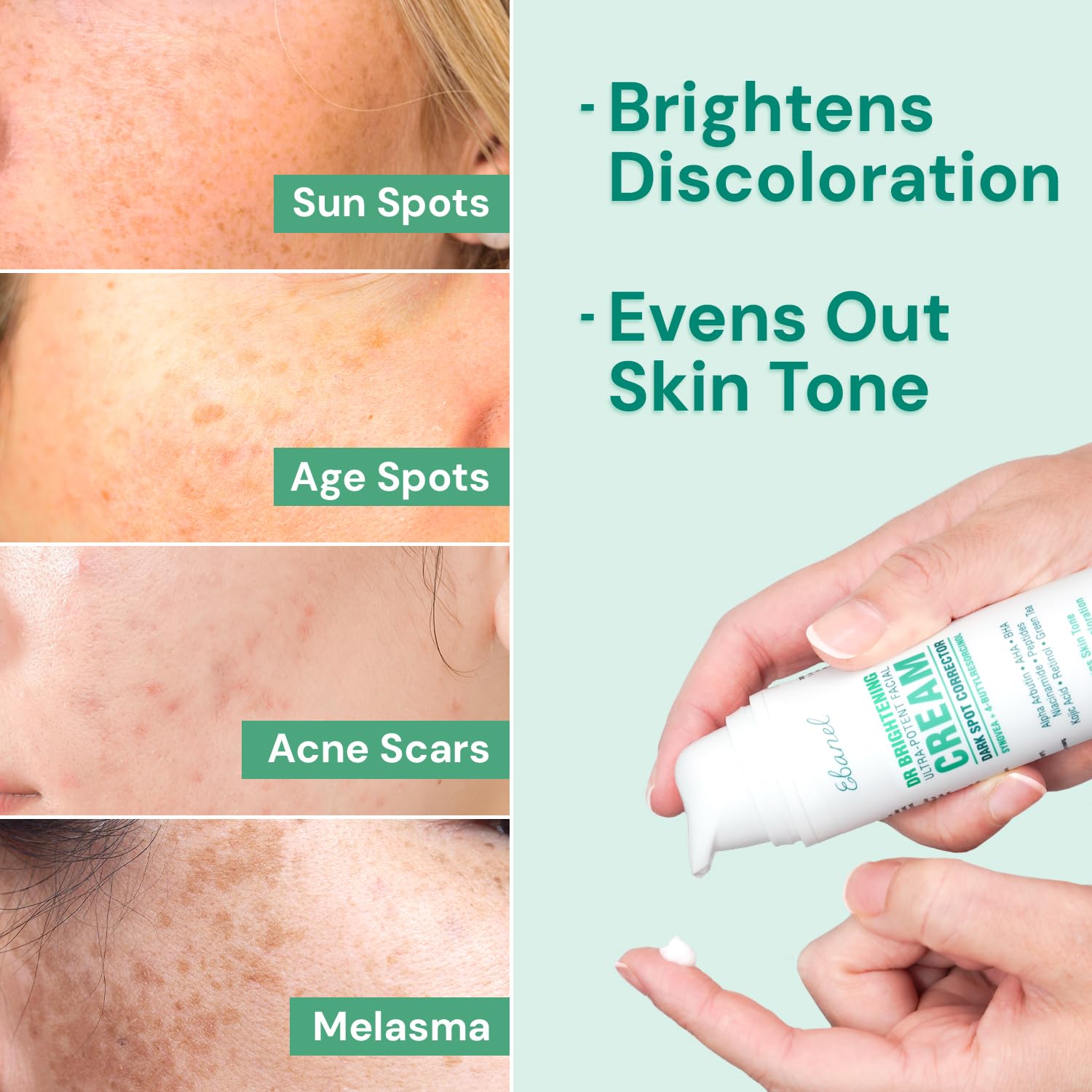 Ebanel dark-spot remover face-neck application demonstrates versatile use on multiple areas.