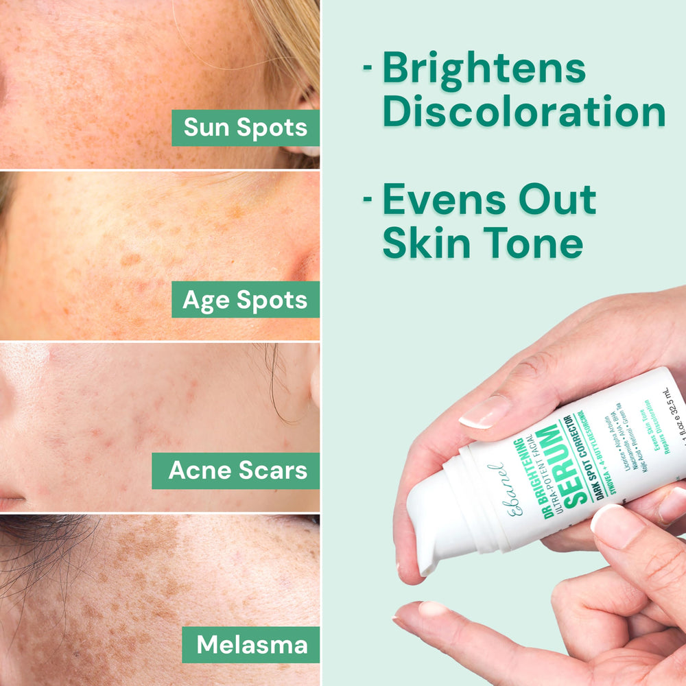 Ebanel dark spot serum on neck and hands shows potential for uniform tone in treated areas.