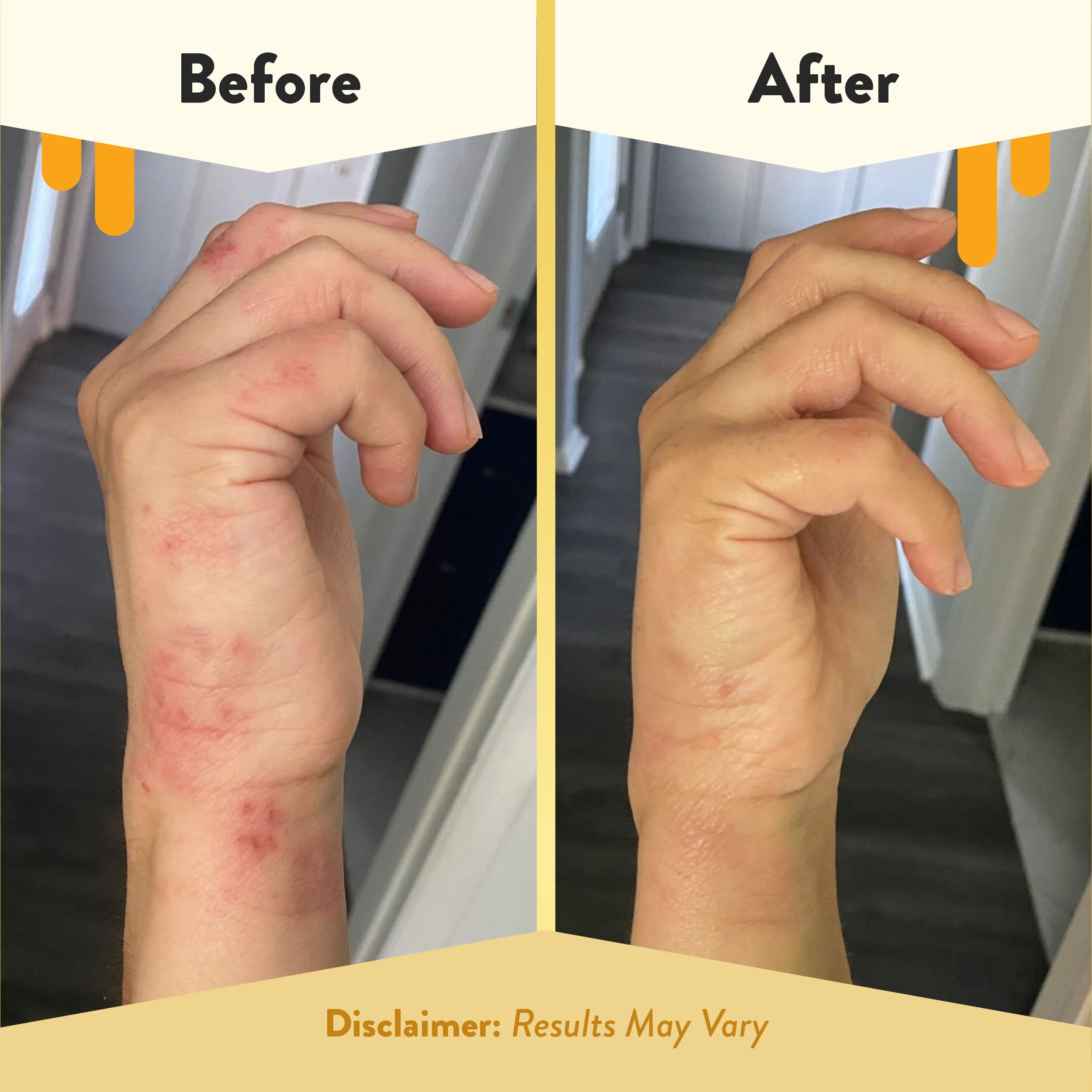 ECZEMA HONEY antioxidant body oil ingredients highlight nourishing oils and oats.