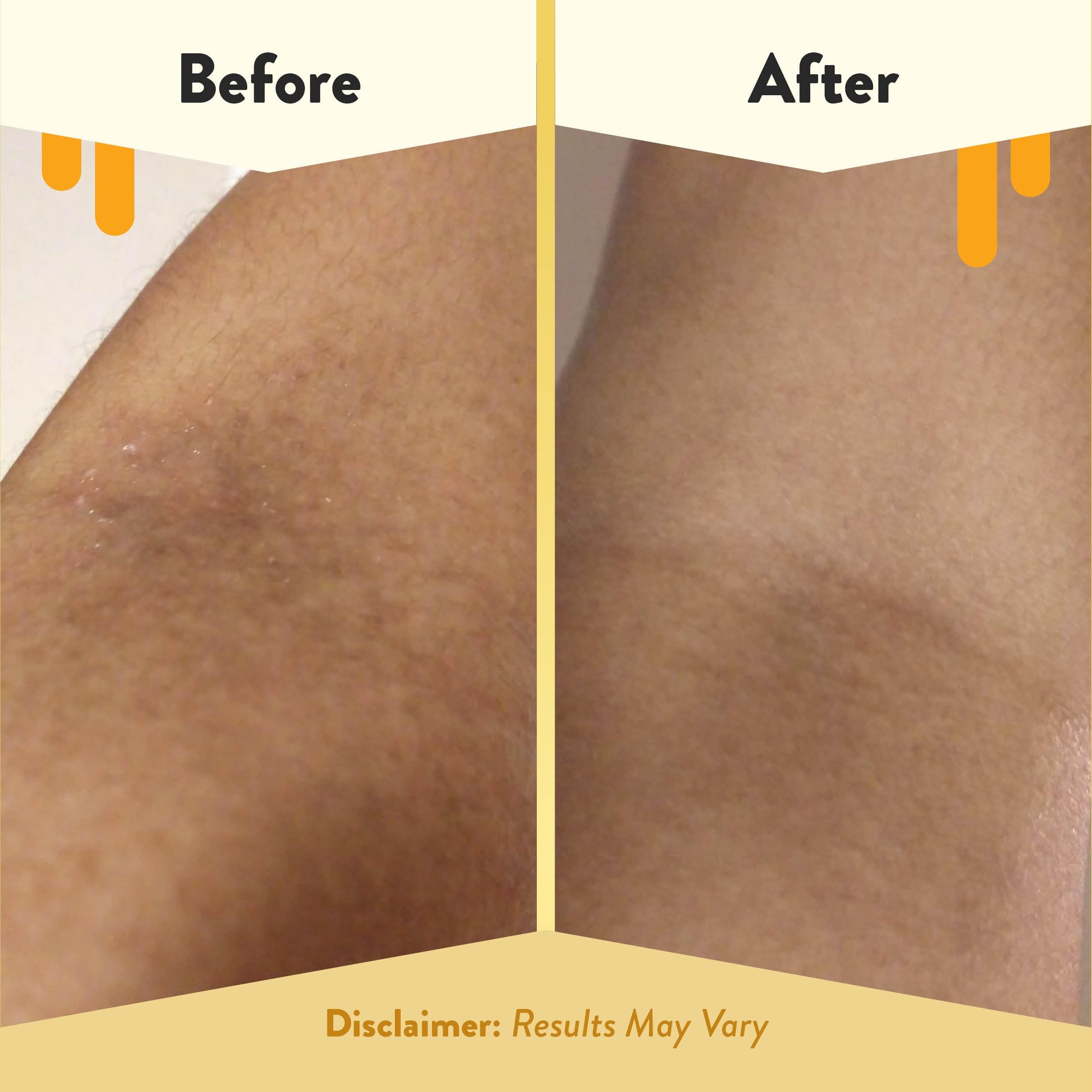 Eczema Honey honey and green tea cleanse without fragrance.