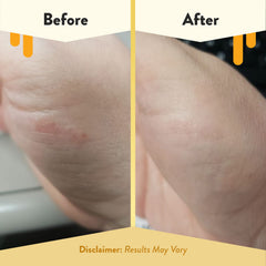 Discos Eczema Honey con aloe y jojoba para hidratación suave.