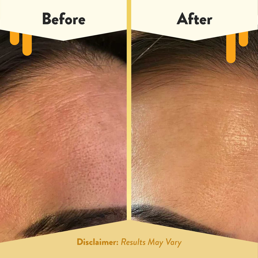 ECZEMA HONEY Nourishing Serum on skin conveys soft glow and immediate hydration
