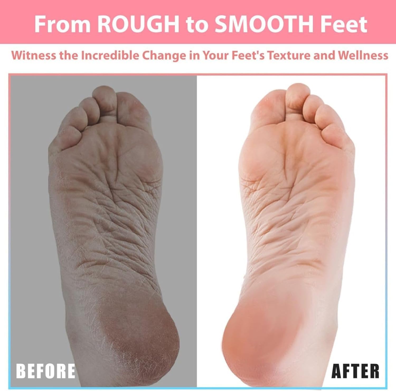 Efforest built-in pumice stone removes dead skin and calluses for refreshed heels