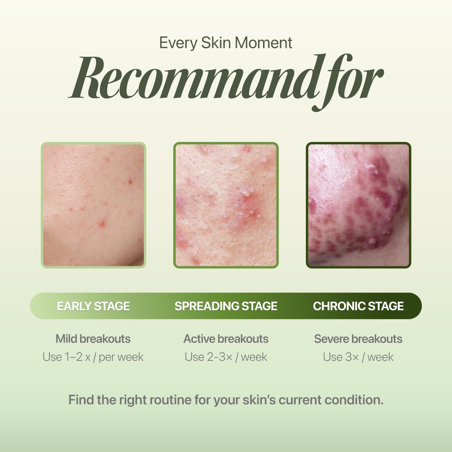 EIOM Trouble Patch Mask sheet adhesion closeup emphasizes close contact for absorption