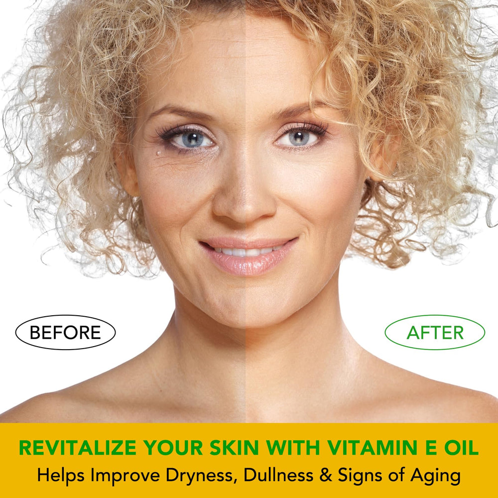 ELBBUB Vitamin E Oil supports scar and stretch-mark care with daily moisture