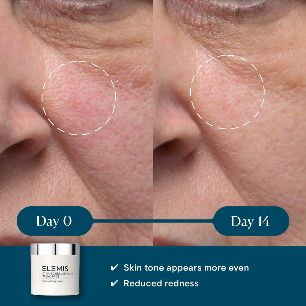 ELEMIS Dynamic Resurfacing Pads textured-side usage reveals exfoliation for refined texture