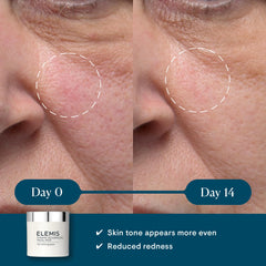 ELEMIS Dynamic Resurfacing Pads textured-side usage reveals exfoliation for refined texture