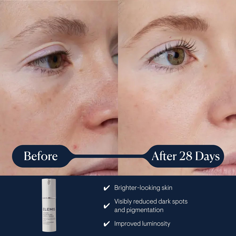 ELEMIS Dynamic Resurfacing Serum application on the face for even tone and smoother texture