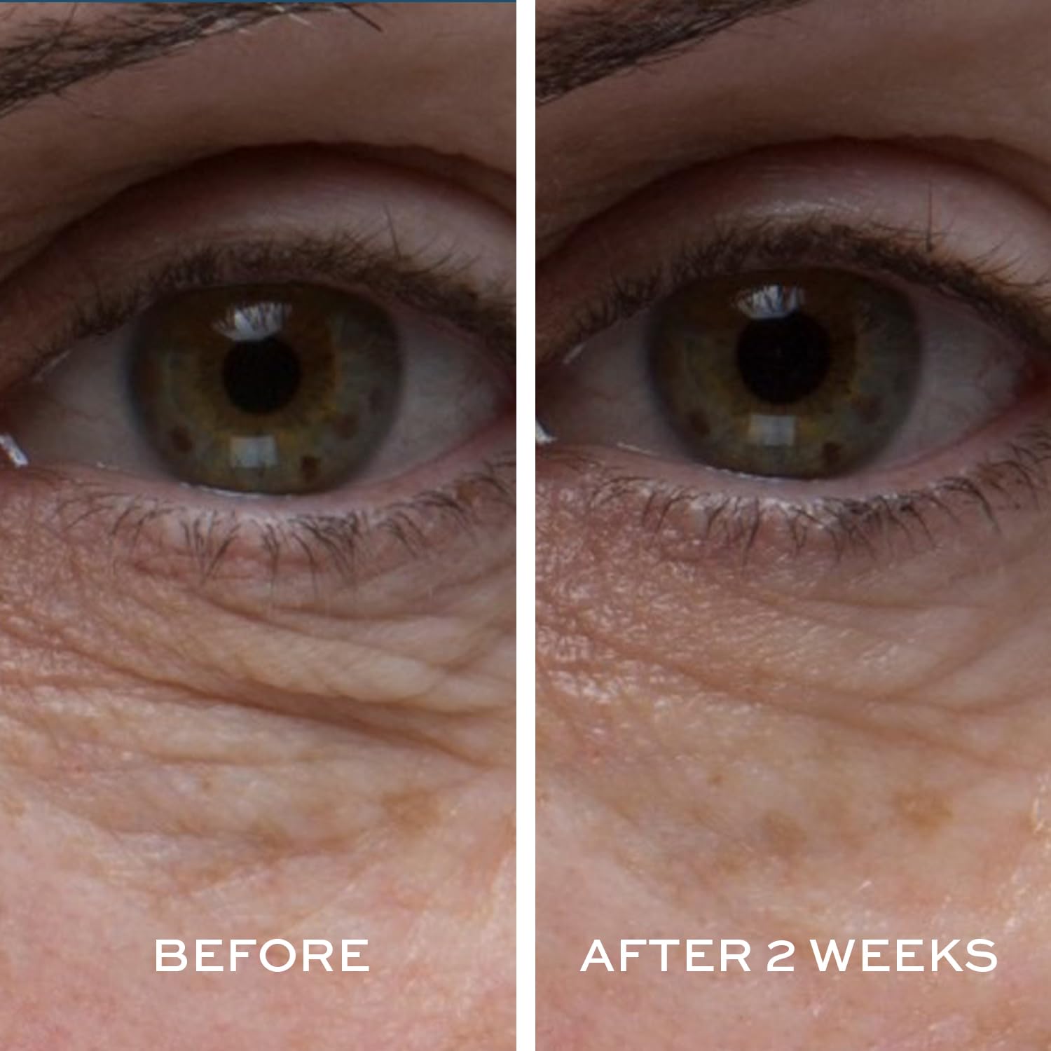 Elemis Hawkweed and Daisy extract target dark shadows for brighter eyes.