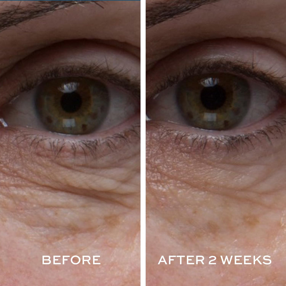 Elemis Hawkweed and Daisy extract target dark shadows for brighter eyes.