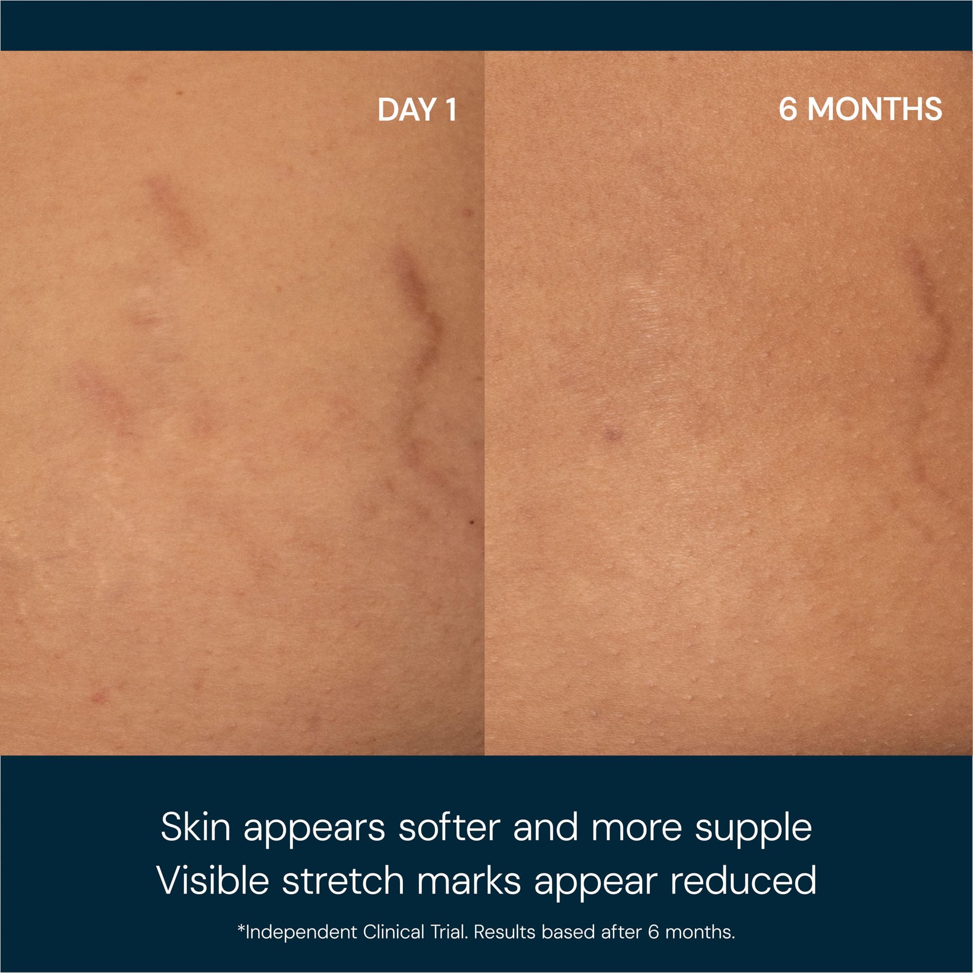ELEMIS Japanese Camellia Body Oil pour demonstrates quick absorption for smooth skin