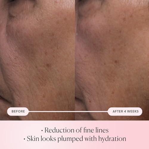 ELEMIS Pro-Collagen Rose Micro Serum dropper closeup for precise, gentle application