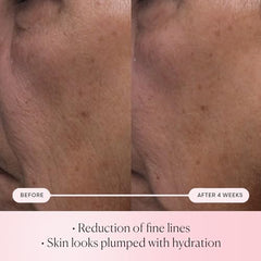 ELEMIS Pro-Collagen Rose Micro Serum dropper closeup for precise, gentle application