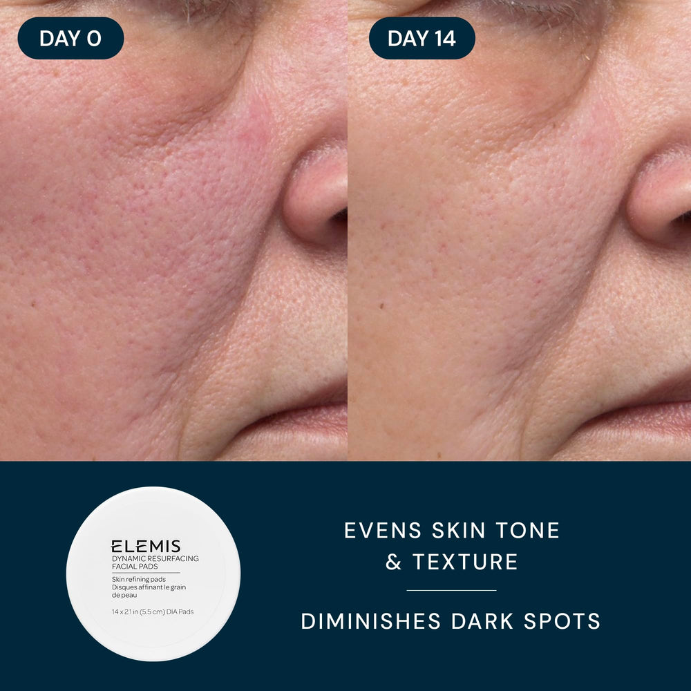 Elemis Step Two Resurfacing Pads for gentle exfoliation during routines