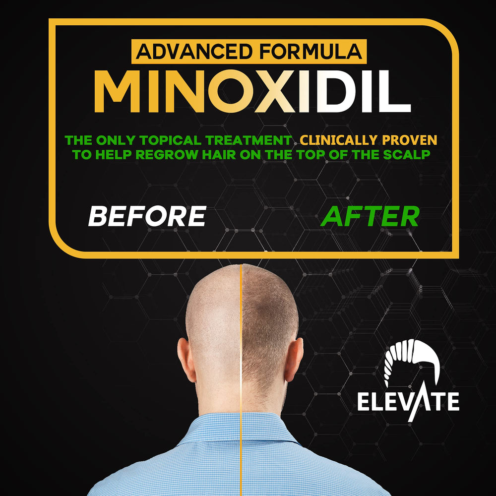 Elevate 5% Minoxidil box packaging highlights the extra-strength formula and usage