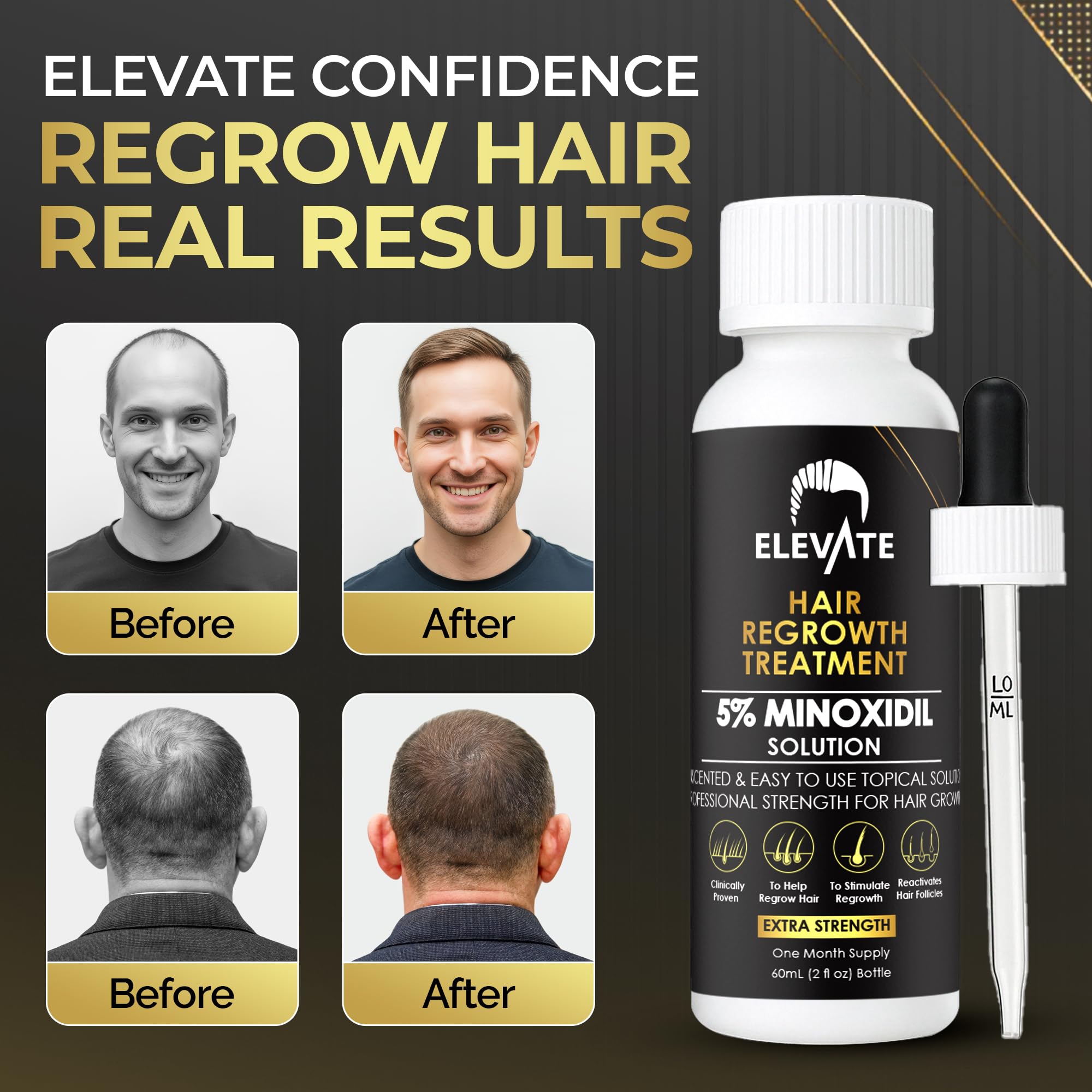 Elevate application drops on dry scalp demonstrates easy twice-daily routine