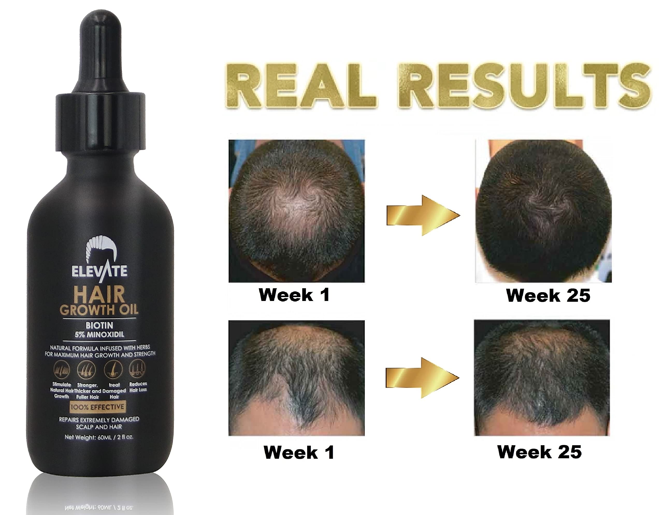 Elevate Scalp Coverage shot shows even distribution across thinning areas