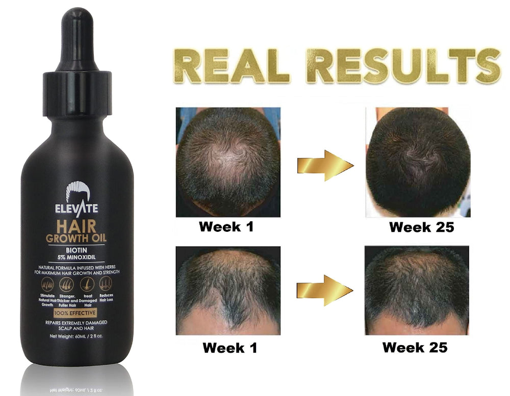 Elevate Scalp Coverage shot shows even distribution across thinning areas