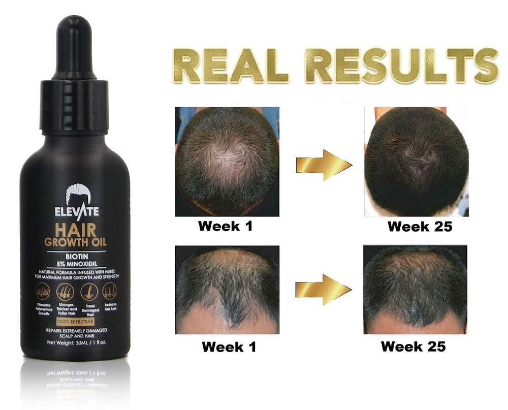 Elevate scalp massage application demonstrates soothing technique to evenly distribute nutrients for healthier roots